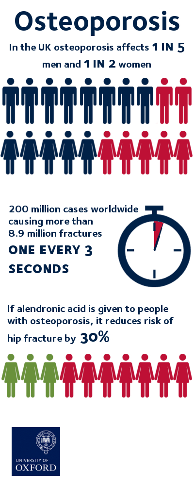 Facts about osteoporosis