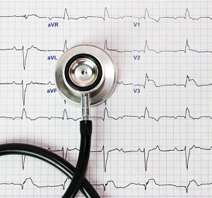 Heart failure in the UK continues to rise; poorest people worst affected