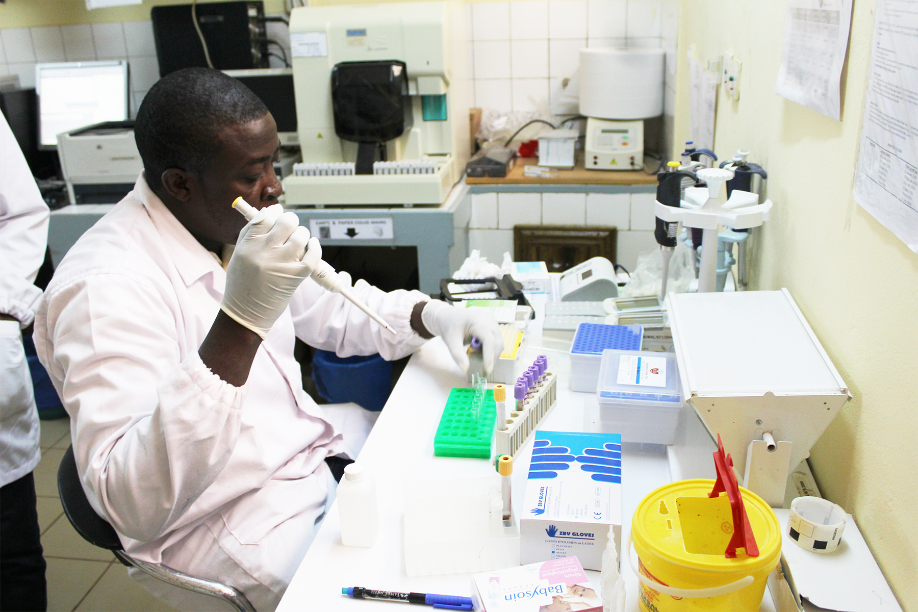 research on malaria diagnosis