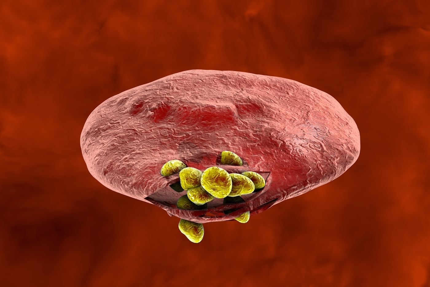 Genes that protect African children from developing malaria identified ...