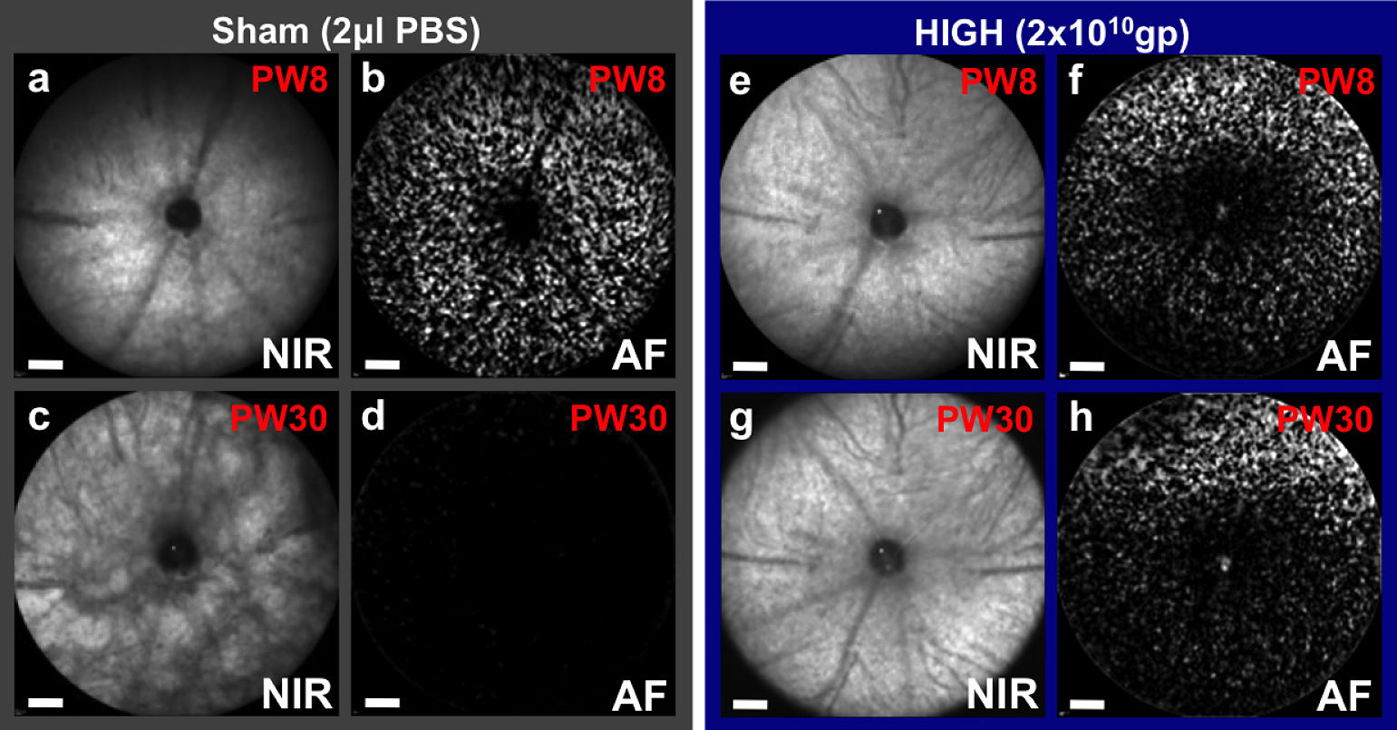 Gene therapy gives long-term protection to photoreceptor cells in a mouse model of retinitis pigmentosa