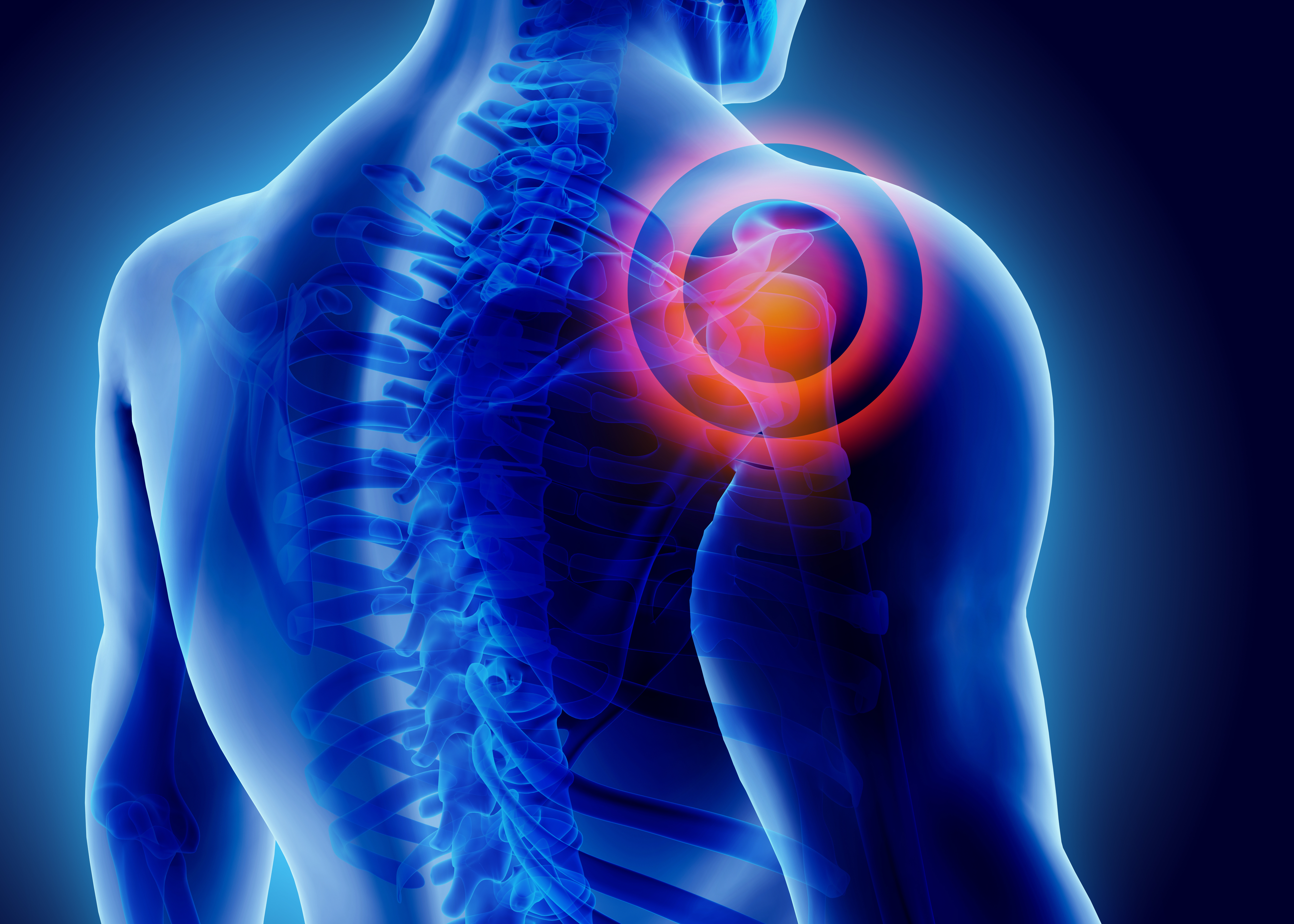  Does common NHS shoulder surgery work?