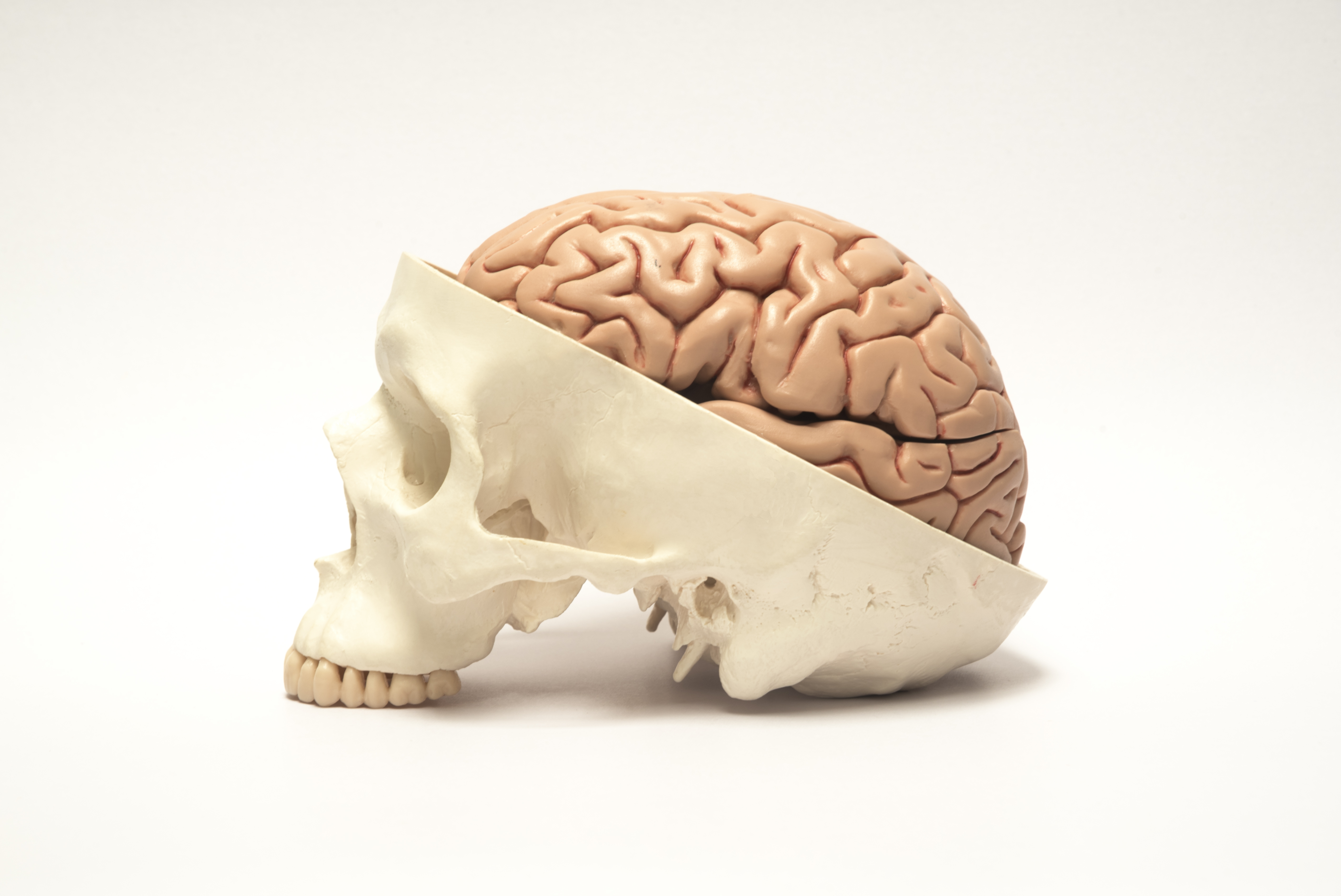 Мозги в черепной коробке. Головной мозг в черепной коробке. Человеческий мозг в черепе.
