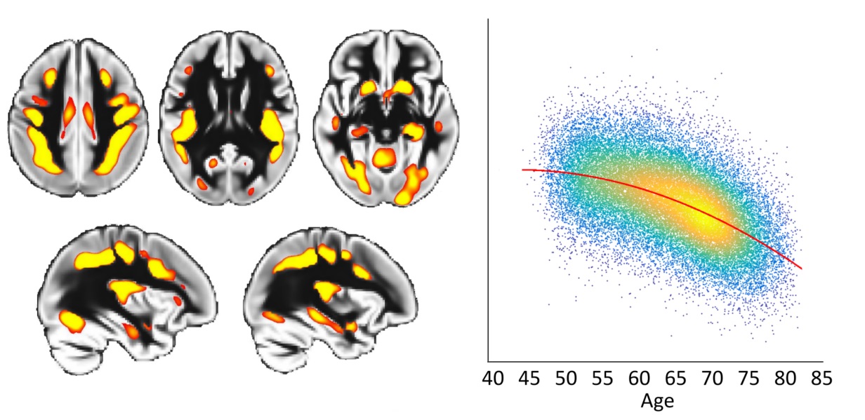 Brain ageing risk factors