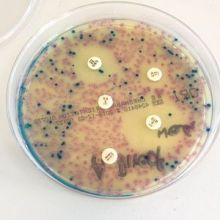 Bacterial culture with antibiotic discs