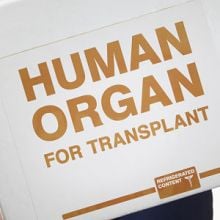 Human organ transport box