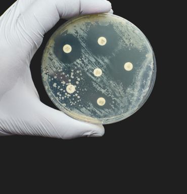 A hand in a latex glove holds up a circular petri dish filled with agar jelly. Bacterial colonies are visible on the dish, but are absent in the areas surrounding small discs that contain antibiotics.  