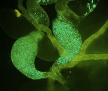 A large amount of fluorescent green sperm within sack-like organs against a black background. 
