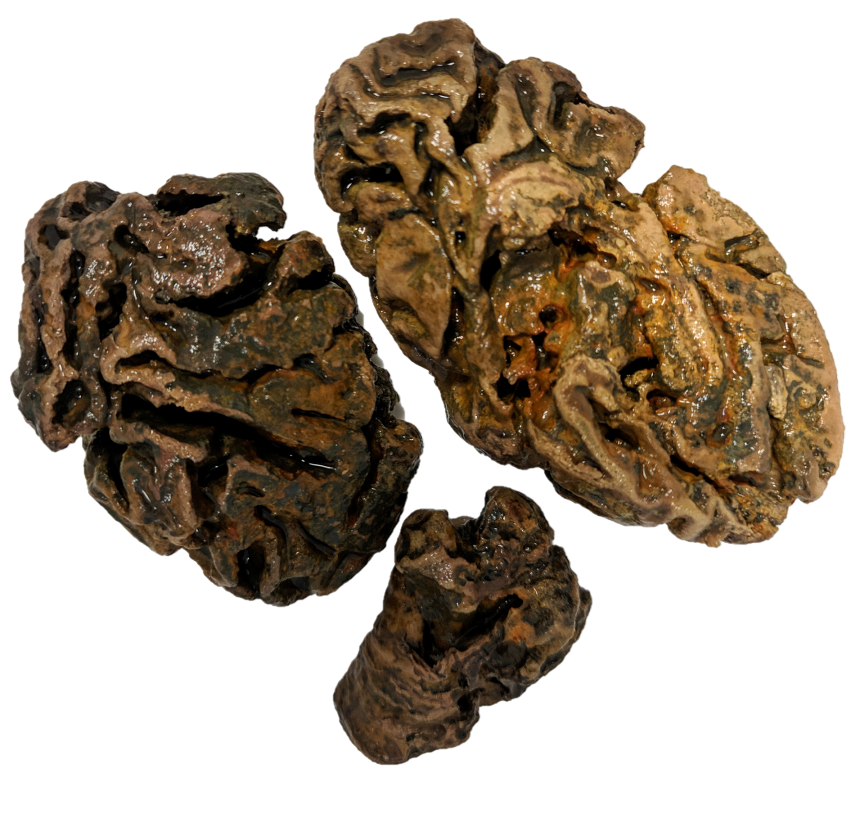 Three fragments of a preserved human brain. The largest fragment is one of the hemispheres.