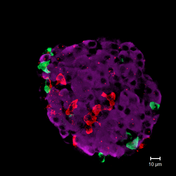 A microscopy image showing mouse islet cells: the purple blobs are insulin-producing beta cells (credit: Dr Quan Zhang, OCDEM)