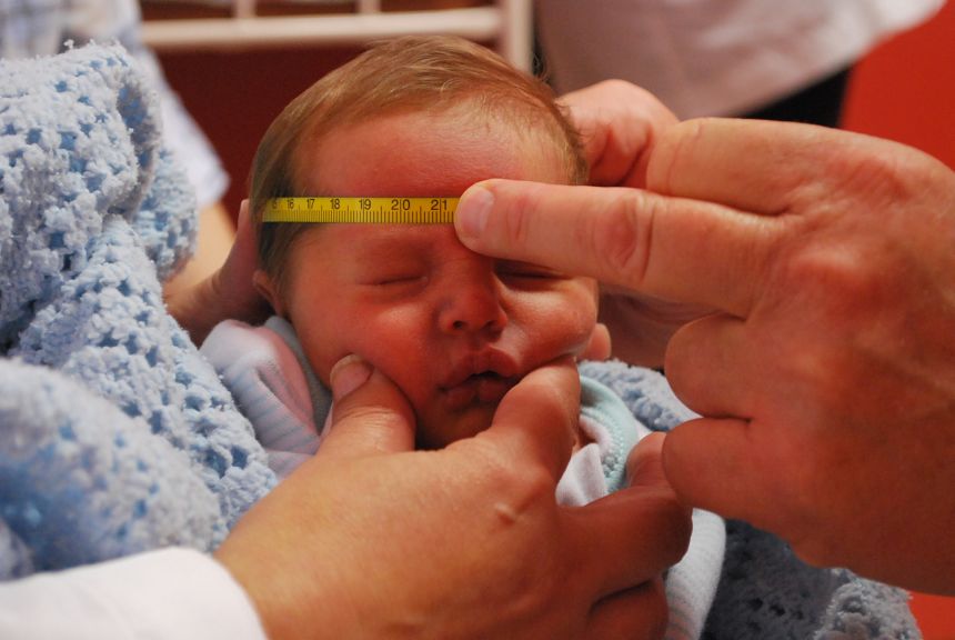 A newborn baby in Brazil has head circumference measured as part of the study