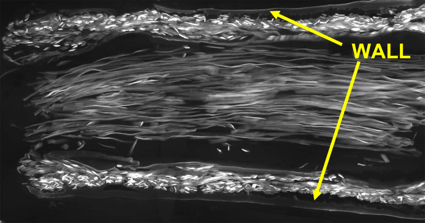 Scanning electron microscope image of a longitudinal section through a silk conduit containing nerve-guiding luminal silk fibres. Image credit: Newrotex Ltd