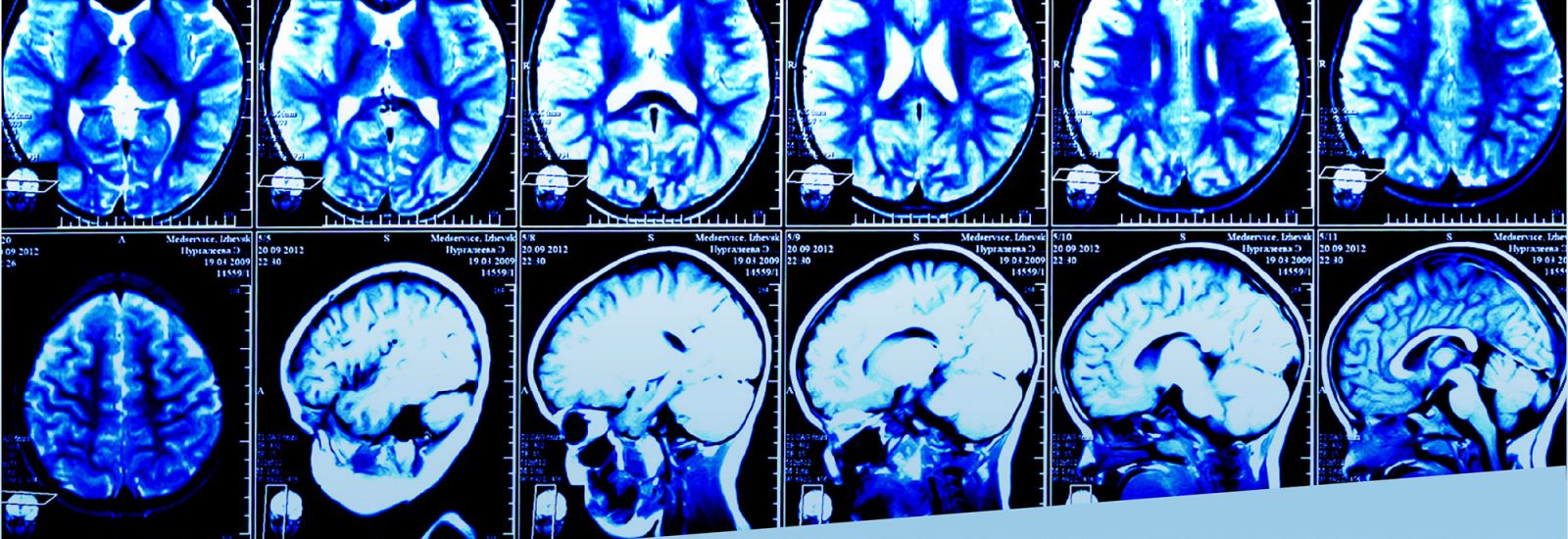 Rows of CT scan images of a brain