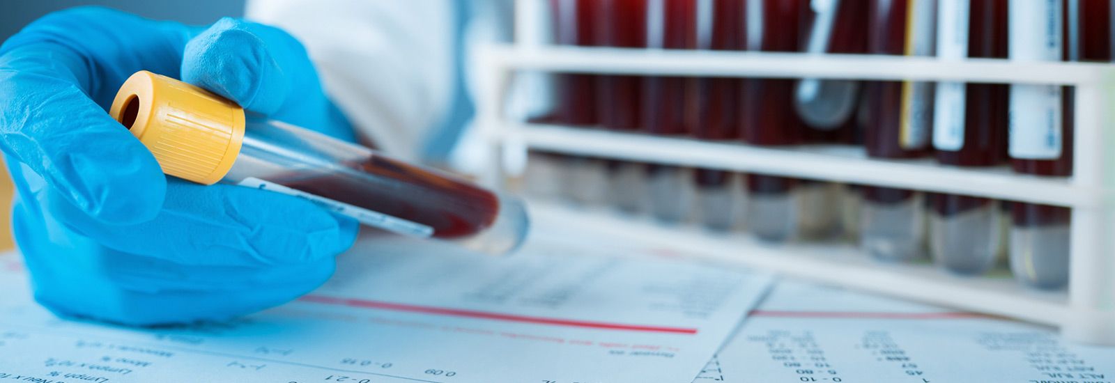 Hand holding blood sample vial