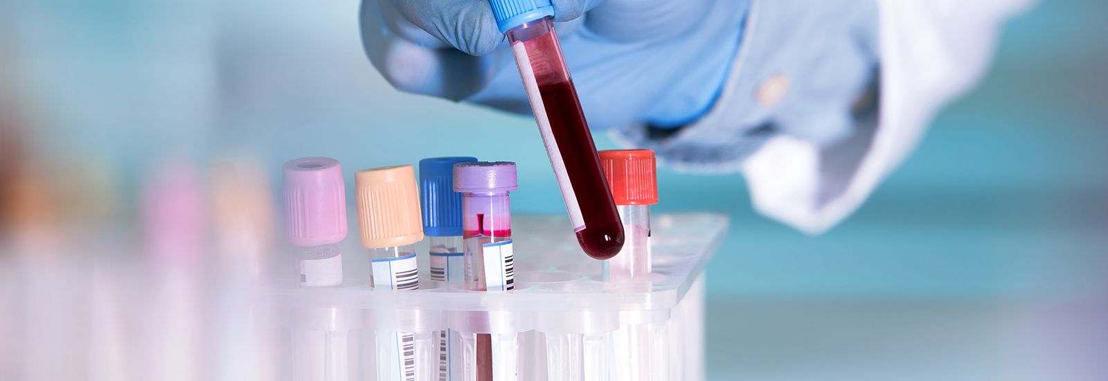 Blood in a test tube