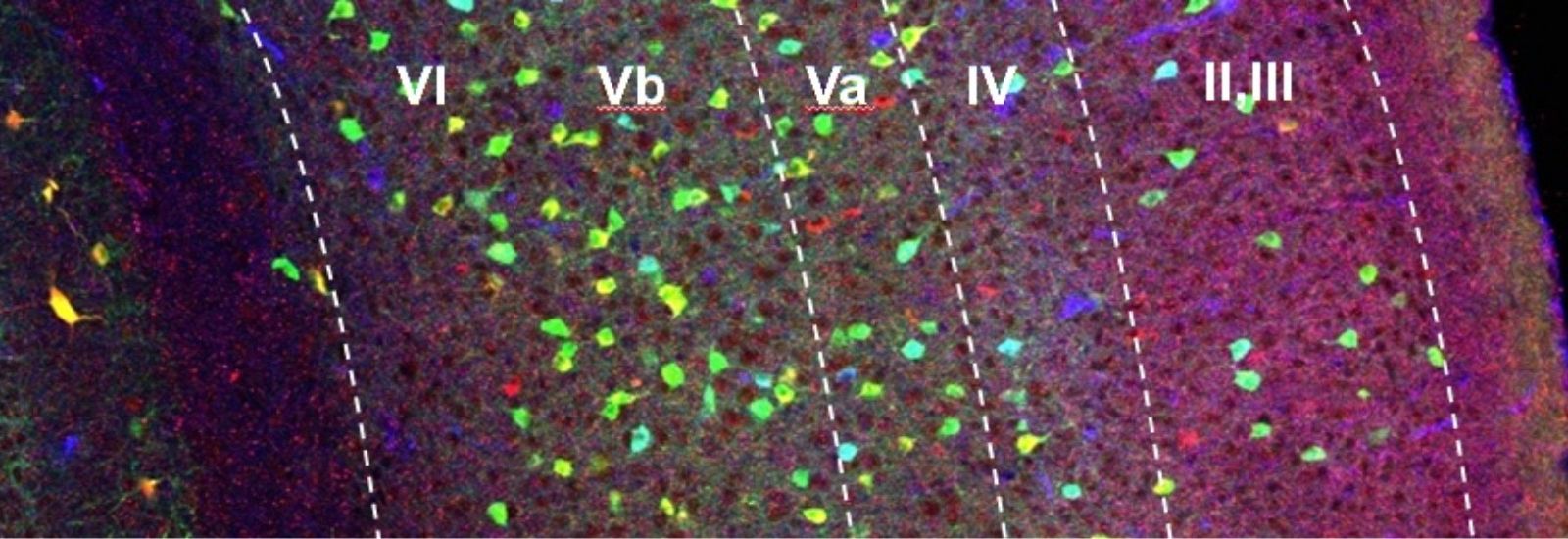 Close up of a image of Inhibitory interneurons