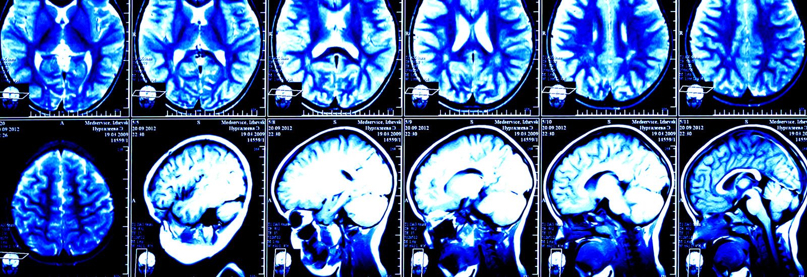 Rows of CT scan images of a brain