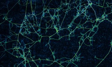 A fungal network, seen as interconnected and branching thread-like structures.