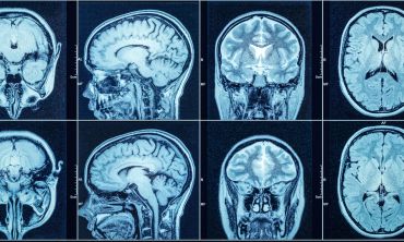 Three or more concussions linked with worse brain function in later life