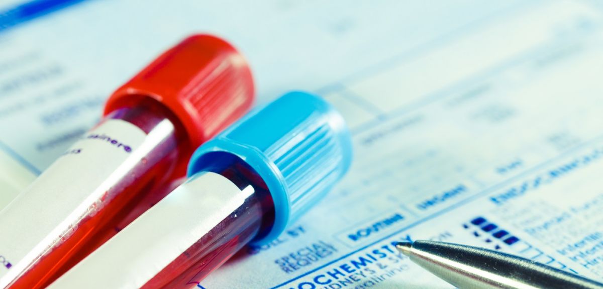 Blood test tubes with paperwork