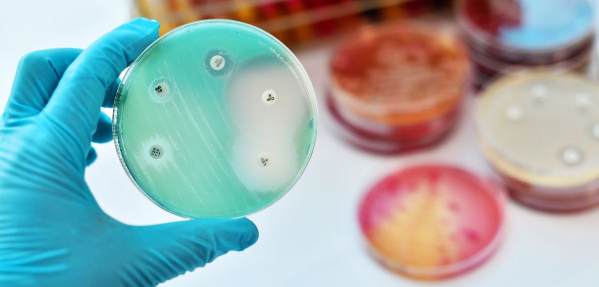 A hand wearing a latex glove holds up a petri dish containing colonies of bacteria for antibiotic testing. In the background, there is a stack of petri dishes and a rack containing test tubes.