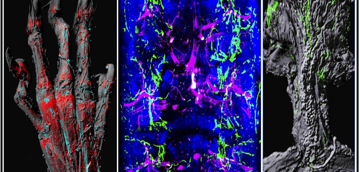 Role of lymphatic system in bone healing revealed
