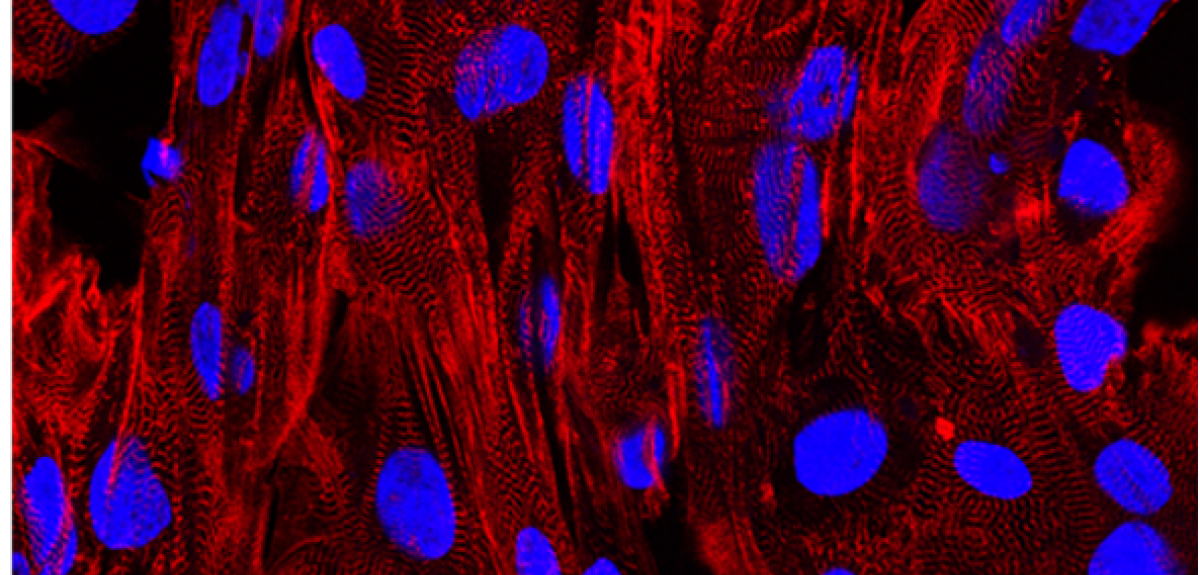 An image depicting human heart cells, which have been programmed to develop from stem cells. Muscle is highlighted in red, while cell nuclei are shown in blue.