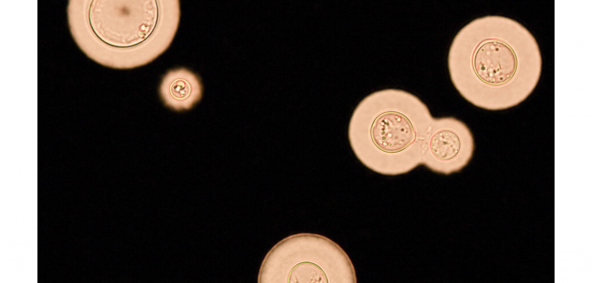 This image shows typical spherical to oval cells of Cryptococcus neoformans, with extensive capsules and a budding daughter cell.
