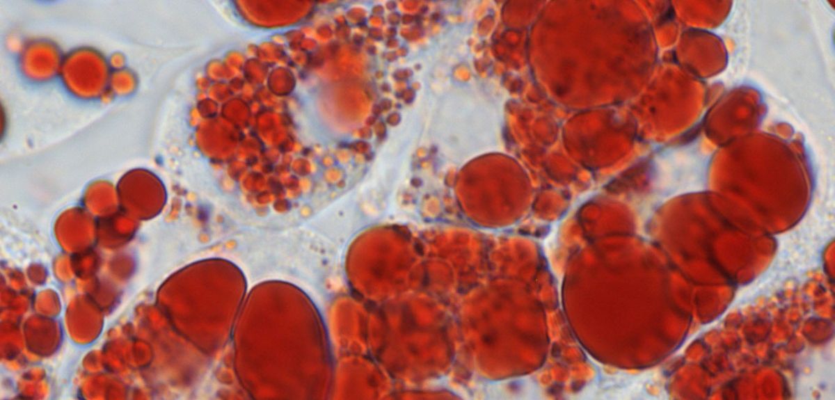 Fat cells stained with Oil Red O to visualise their lipid droplets.