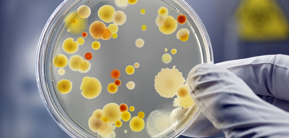 Colonies of bacteria seen as circular growths of differing sizes, growing on a petri dish filled with clear agar. The dish is held up by a latex gloved hand, and there is a biohazard sign in the background.
