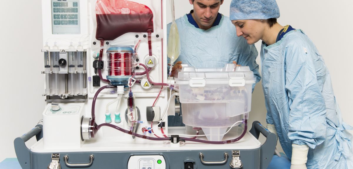 Body temperature liver storage technique improves transplant success