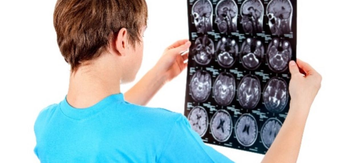 Student looking at brain scan