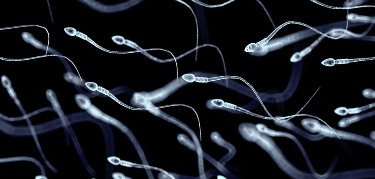 Spermatozoa, viewed under microscope, illuminated against a dark background.