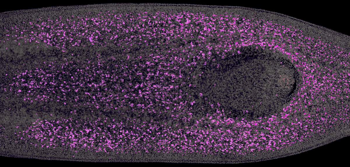 Planarian: all cells in white, stem cells in cyan