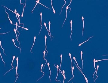 Sperm