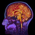 MRI scans reveal how brain protects memories