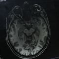 Anatomical brain scan