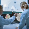 Brainomix scientists analysing brain scan