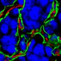 Cancer cells (blue) invade alveolar spaces in lung (green walls) and co-opt blood vessels (red)