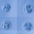 Early stage human embryo