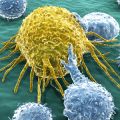 Cancer cell and lymphocytes 