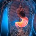Major new study aims to improve surgery options for acid reflux patients